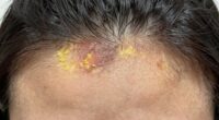 identifying scalp buildup issues