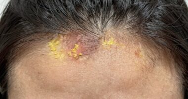 identifying scalp buildup issues